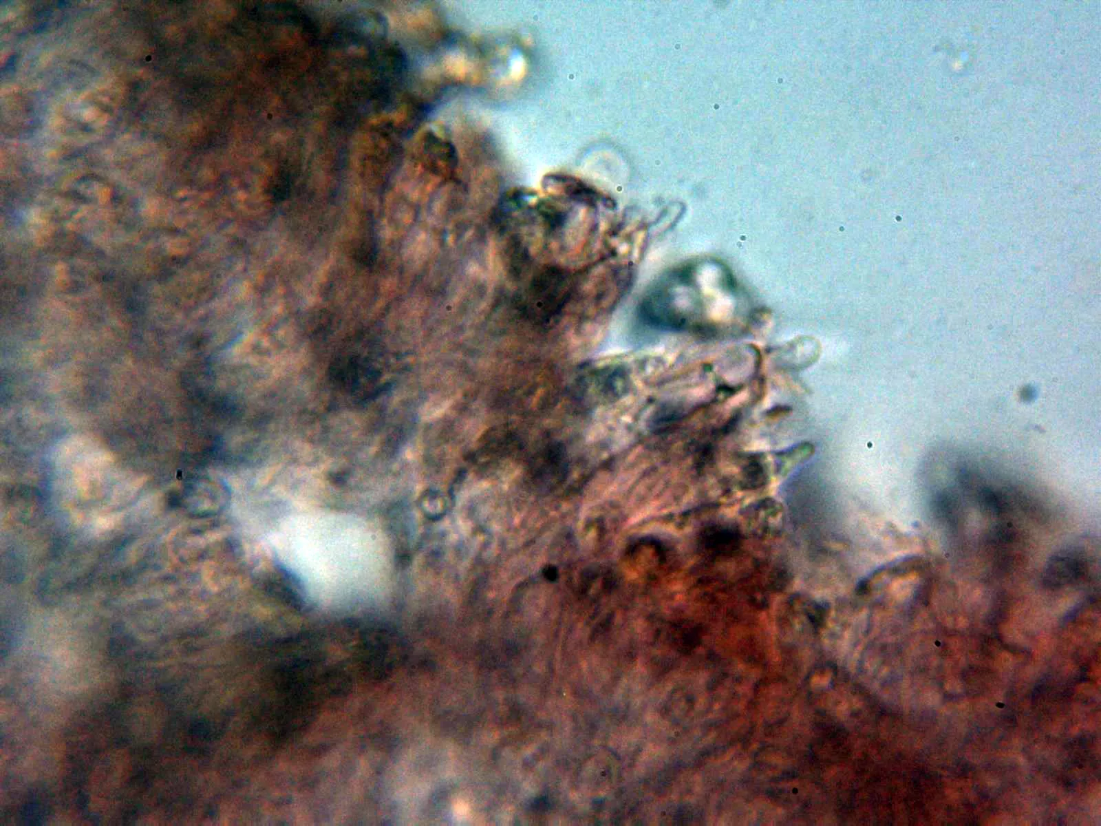 Microscopía de Rhodocybe truncata - 10 - Pelos arista 1